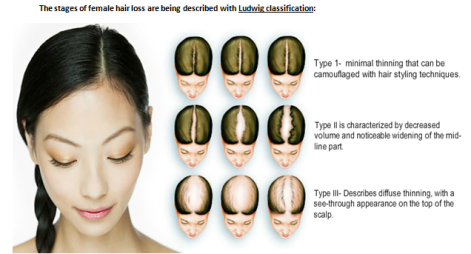 female-hair-loss-drkouremada